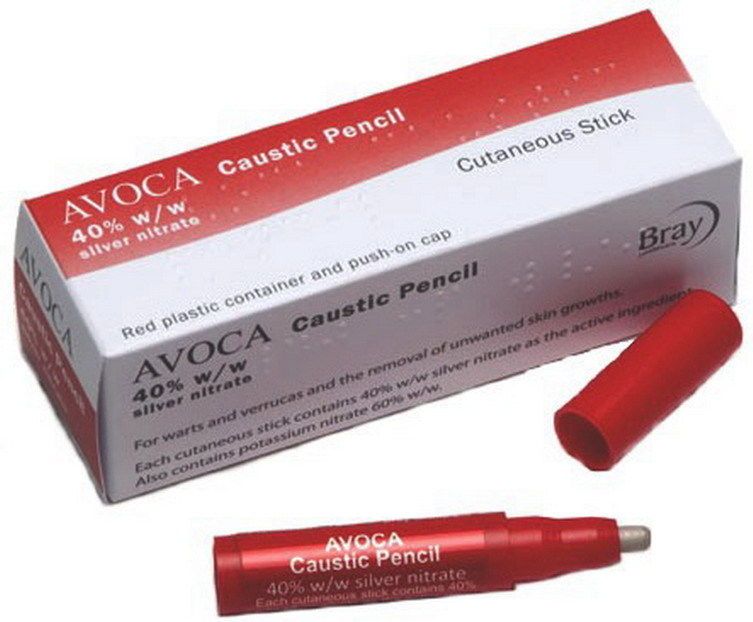 AVOCA CAUSTIC PENCIL 40%W/W SILVER NITRATE WART & VERRUCA TREATMENT - 1